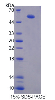 Recombinant Thrombomodulin (TM)