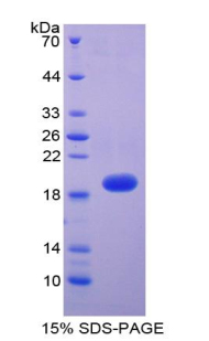 RPA529Hu02.jpg