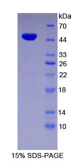 Recombinant Enolase, Neuron Specific (NSE)