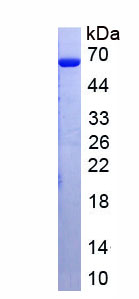 Recombinant Immunoglobulin M (IgM)