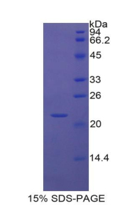 Recombinant Vascular Cell Adhesion Molecule 1 (VCAM1)