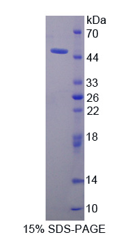 Recombinant Tissue Inhibitors Of Metalloproteinase 1 (TIMP1)