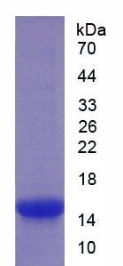 Recombinant Tissue Inhibitors Of Metalloproteinase 1 (TIMP1)