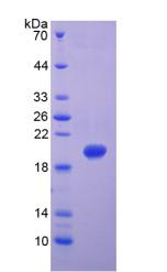 Recombinant Matrix Metalloproteinase 9 (MMP9)