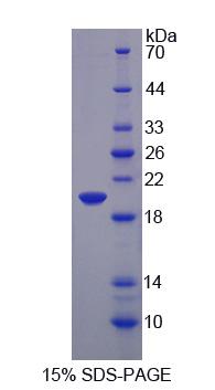 Recombinant Matrix Metalloproteinase 9 (MMP9)