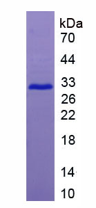 RPA554Hu01.jpg