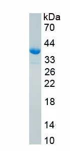 RPA556Hu03.jpg