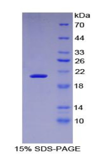 RPA561Hu02.jpg