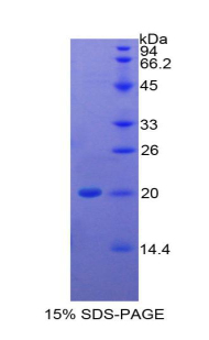 Recombinant Interleukin 1 Beta (IL1b)