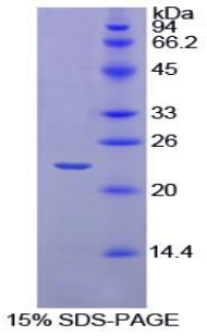 Recombinant Interleukin 1 Beta (IL1b)