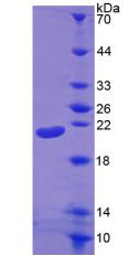 Recombinant Interleukin 1 Beta (IL1b)