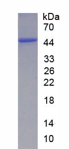 Recombinant Interleukin 1 Beta (IL1b)