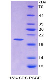 Recombinant Interleukin 1 Beta (IL1b)