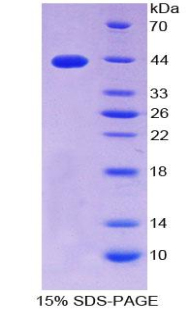 Recombinant S100 Calcium Binding Protein B (S100B)