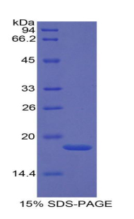 RPA569Hu01.jpg