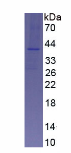 Recombinant Aquaporin 1 (AQP1)