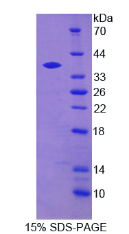 Recombinant Heme Oxygenase 1 (HO1)