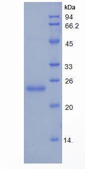 Recombinant Heme Oxygenase 1 (HO1)