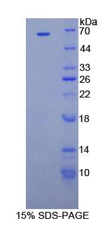 RPA585Hu01.jpg