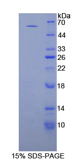 Recombinant Proliferating Cell Nuclear Antigen (PCNA)