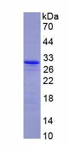 RPA599Hu01.jpg