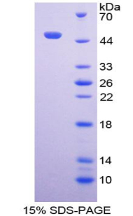 RPA606Hu01.jpg