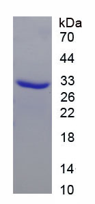 RPA615Hu01.jpg