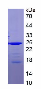 Recombinant Transcription Factor P65 (NFKB3)