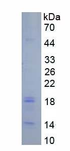 RPA626Hu03.jpg