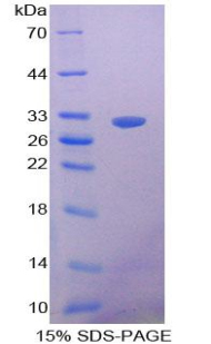 RPA628Hu01.jpg