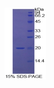 RPA631Hu01.jpg