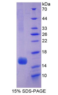 RPA637Hu01.jpg