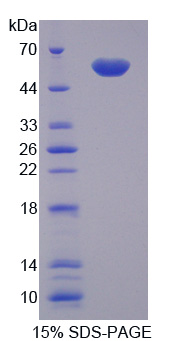 RPA638Hu01.jpg