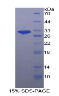 Recombinant Aldolase A, Fructose Bisphosphate (ALDOA)