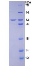 RPA651Hu01.jpg