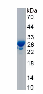 RPA657Hu01.jpg