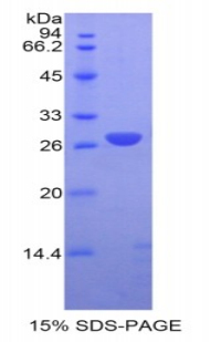 RPA658Hu01.jpg