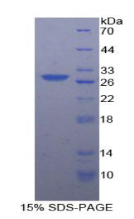 RPA661Hu01.jpg