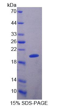 Recombinant Slit Homolog 2 (Slit2)