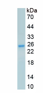 Recombinant Dopamine Receptor D2 (DRD2)