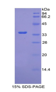 RPA675Hu03.jpg