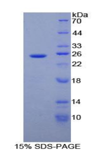 RPA681Hu01.jpg