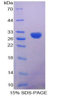 RPA687Hu01.jpg