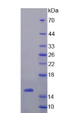 Recombinant Procalcitonin (PCT)