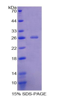 RPA694Hu01.jpg