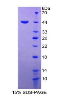 RPA698Hu02.jpg