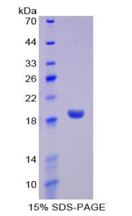 Recombinant Delta-Sleep Inducing Peptide (dSIP)