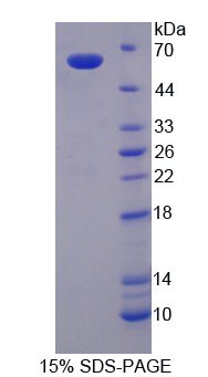 RPA716Hu01.jpg