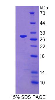 Recombinant ADP Ribosyltransferase 4 (ART4)