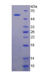 Recombinant Mannose Receptor C Type 2 (MRC2)